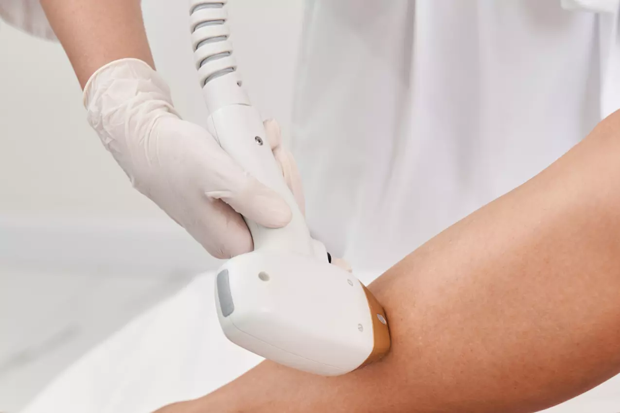 DPL Laser & Vein Removal